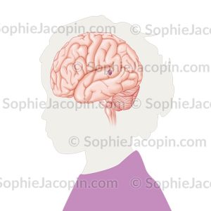 MALFORMATION VASCULAIRE CÉRÉBRALE